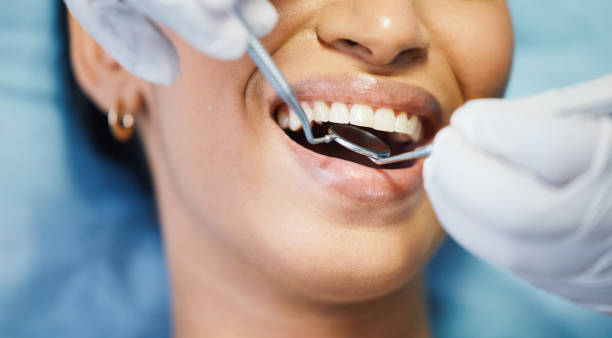 Best Lost Filling or Crown Replacement in Seaman, OH